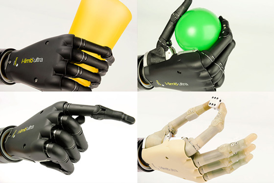 4-Touch-Bionics-I-Limb-Ultra-iPhone-MaxiApple-com Touch Bionics I-Limb Ultra iPhone